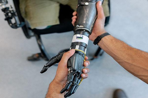 Prosthetic Arm